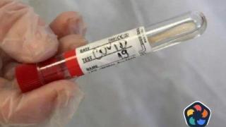 Вариантът XBB.1.5 на Covid вече циркулира у нас