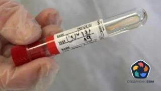 Случаите на Covid-19 вече ще се съобщават веднъж седмично