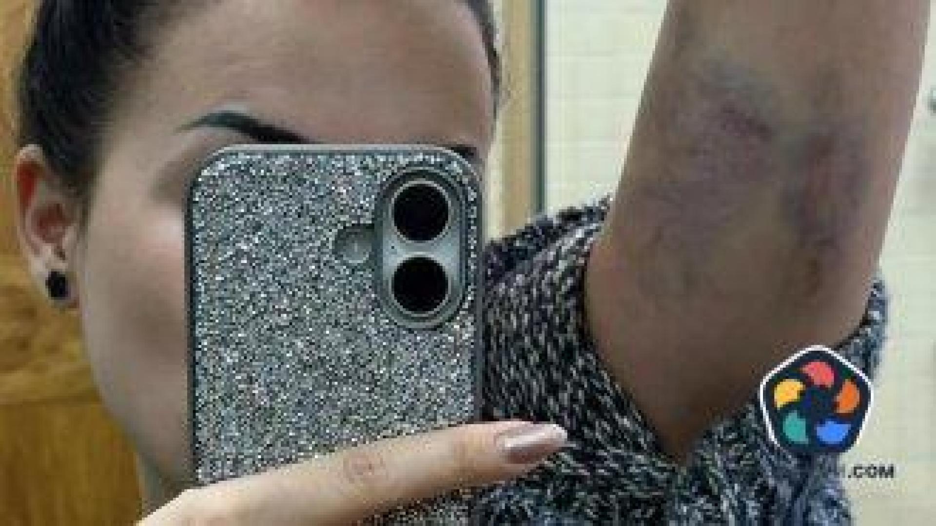 Млада жена се оплака от полицейско насилие при проверка на пътя