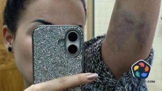 Млада жена се оплака от полицейско насилие при проверка на пътя