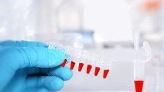 Пациентите останаха излъгани за биомаркерната диагностика