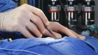 Първата успешна трансплантация на пикочен мехур бе извършена в Калифорния